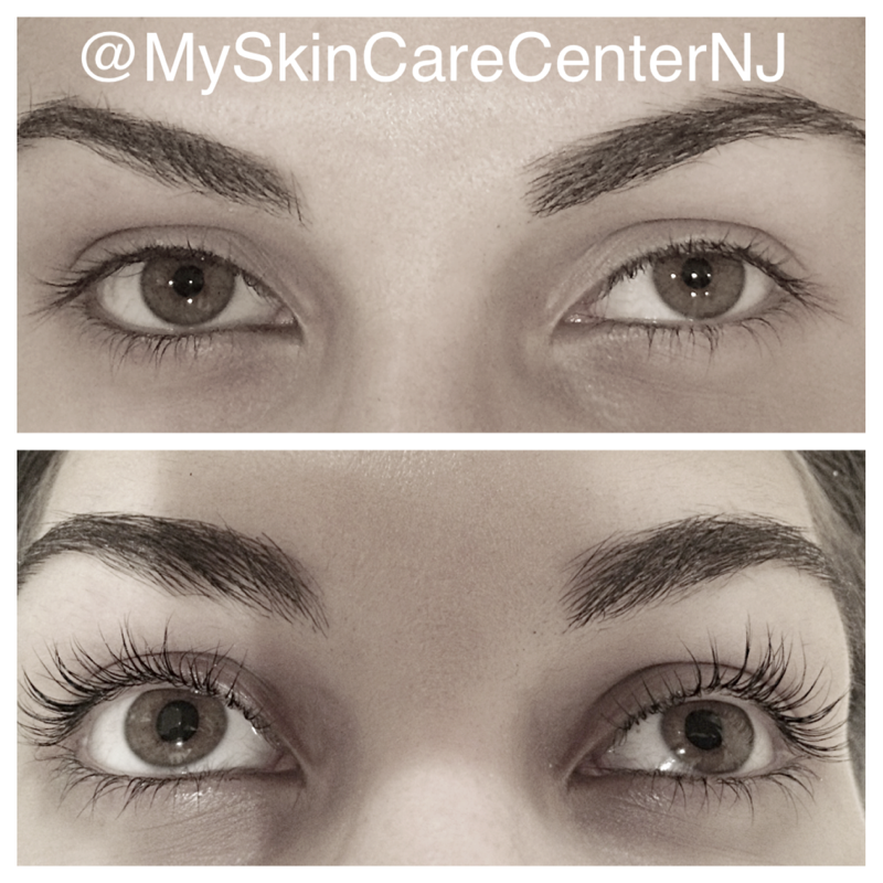 lash lift with tint before & after
